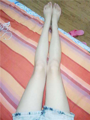 東方和諧王自謙醫(yī)生做的大腿抽脂，分享一下我的果吧~