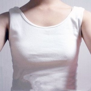 廣元美華楊林醫(yī)生做的自體脂肪隆胸，兩個月的果圖片分享~