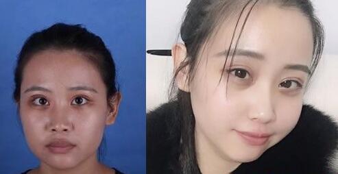 好消息!南寧華美10月20-21日邀請(qǐng)廖連平、劉志剛和徐艦來院坐診~