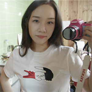 北京南加高紅霞醫(yī)生做的頭發(fā)種植，恢復(fù)得很好~