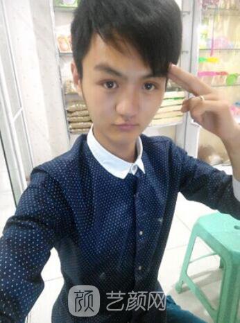 熊清華唇腭裂整形修復案例照片