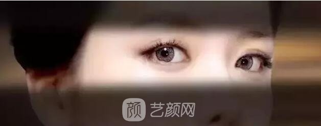 北京藝星整形Yestar分齡祛眼袋真實案例圖分享哦~