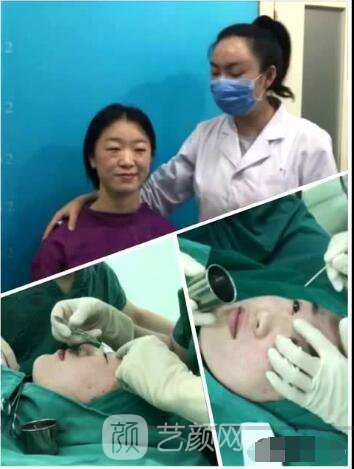 北京八大處整形布仁全切雙眼皮真實案例|圖