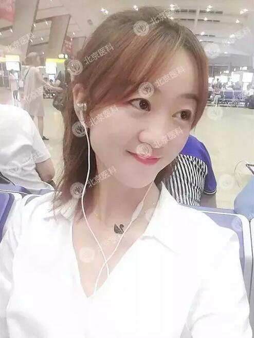 北京八大處整形布仁全切雙眼皮真實案例|圖