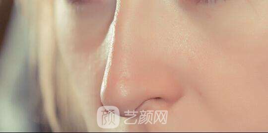 北京做修復(fù)鼻子需要多少錢(qián)？