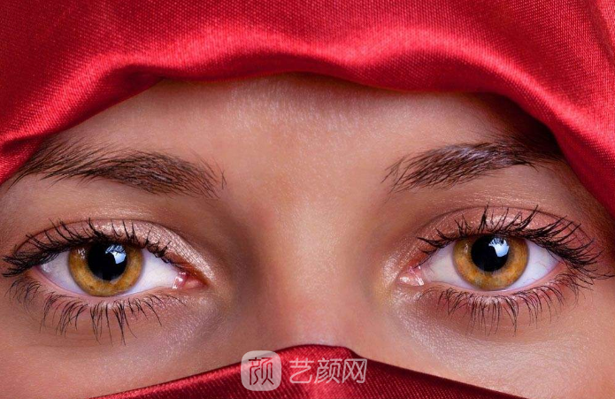 雙眼皮案例：從窄雙眼皮到寬雙眼皮——美，沒有界限。