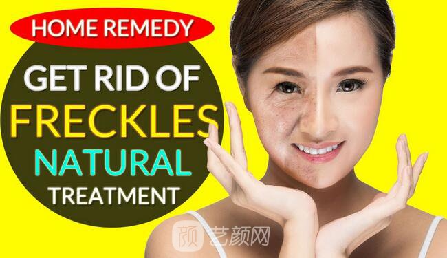 湖南激光祛斑好嗎？