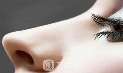 濟(jì)南隆鼻多少錢哪個(gè)醫(yī)院比較好