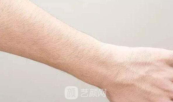 蘭州醫(yī)院激光脫毛多少錢(qián)