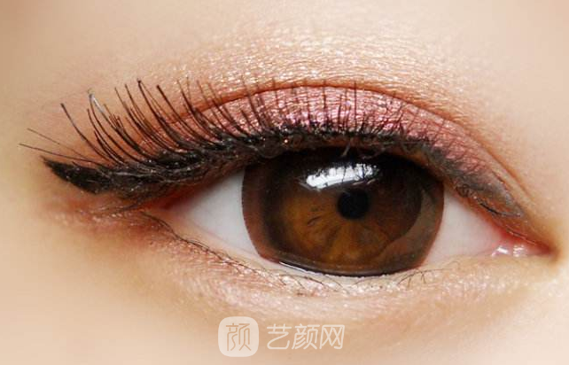 遼陽(yáng)做雙眼皮去哪家醫(yī)院做果好