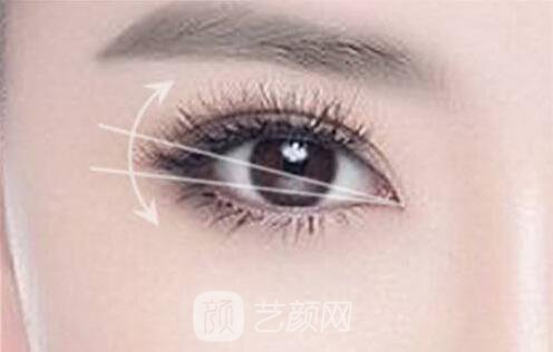 遼陽(yáng)做雙眼皮去哪家醫(yī)院做果好