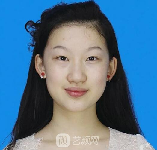 鄭裕錫歐巴駕到：扇形&平行如何選？