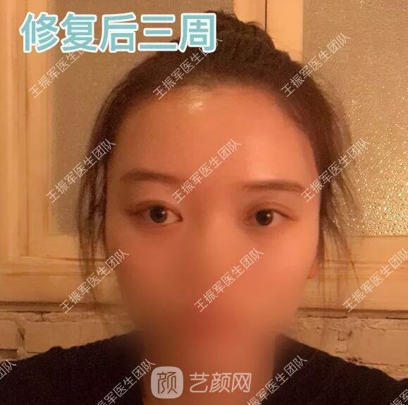 術(shù)后三周果