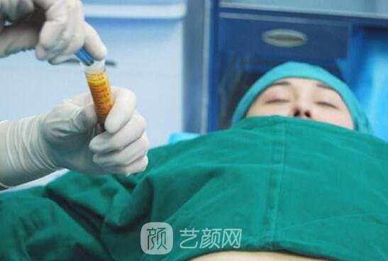 廉紅偉在水動力吸脂方面有著嫻熟的手法，他的方法對身體傷害極小