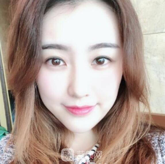 總體消化吸收的十分較為好，看上去看起來自身更年輕