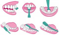 開講啦！種植牙護理大課堂鼓樓專場，上門就送598元大禮包！