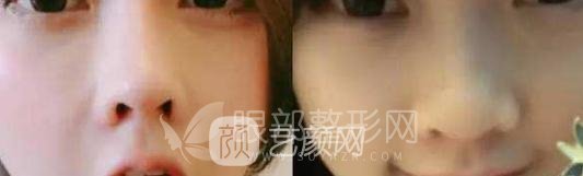 斗魚第一女主播馮提莫的進化史：從素人到網(wǎng)紅！