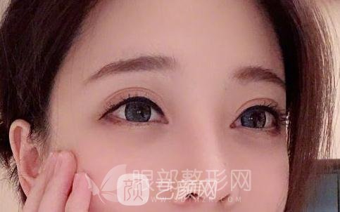 斗魚第一女主播馮提莫的進化史：從素人到網(wǎng)紅！