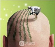 上海三甲醫(yī)院植發(fā)價(jià)格表